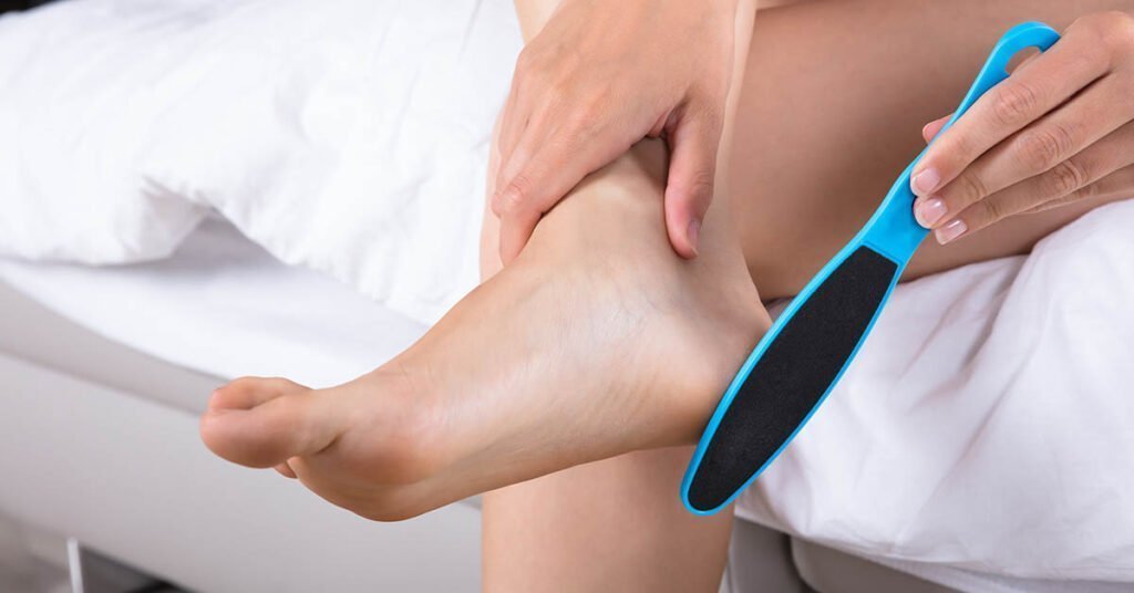 Ta bort förhårdnader med förhårdnadsfil - steg för hemmabehandling